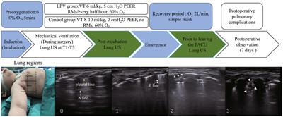 A comparison of the effects of lung protective ventilation and conventional ventilation on the occurrence of atelectasis during laparoscopic surgery in young infants: a randomized controlled trial